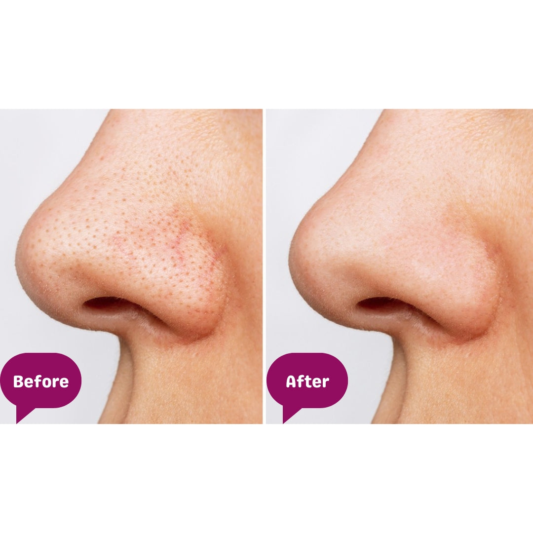 Skincare Facial Scrubber