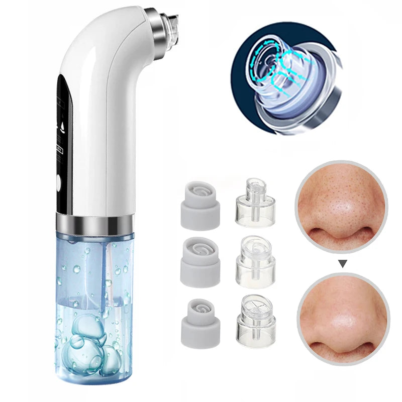 Blackhead Remover Tool