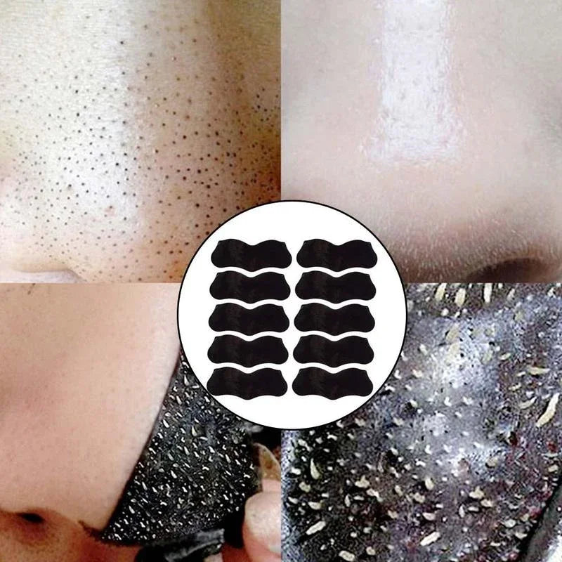 Nose Blackhead Remover Mask
