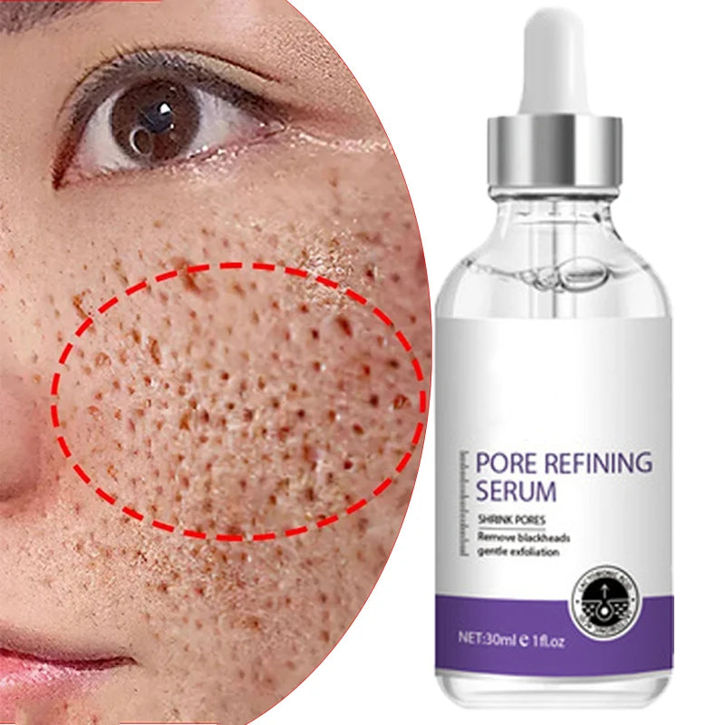 Skin Texture | Pore Refining Resurfacing